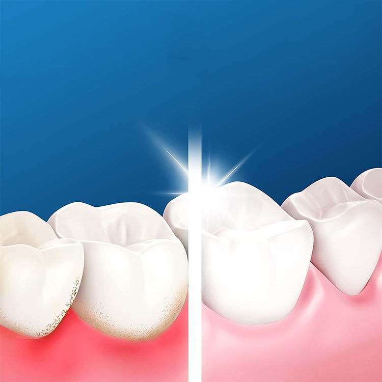 خمیر دندان اورال-بی سری Gum And Enamel Repair حجم 75 میل