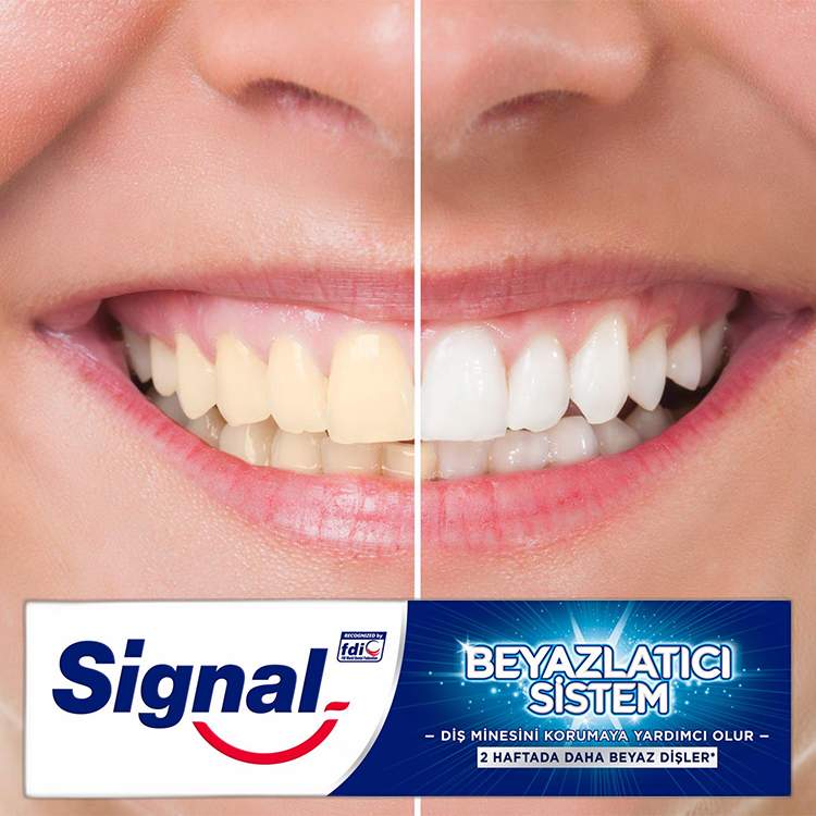 خمیر دندان سفید کننده سیگنال مدل BEYAZLATICI SYSTEM حجم 75 میل